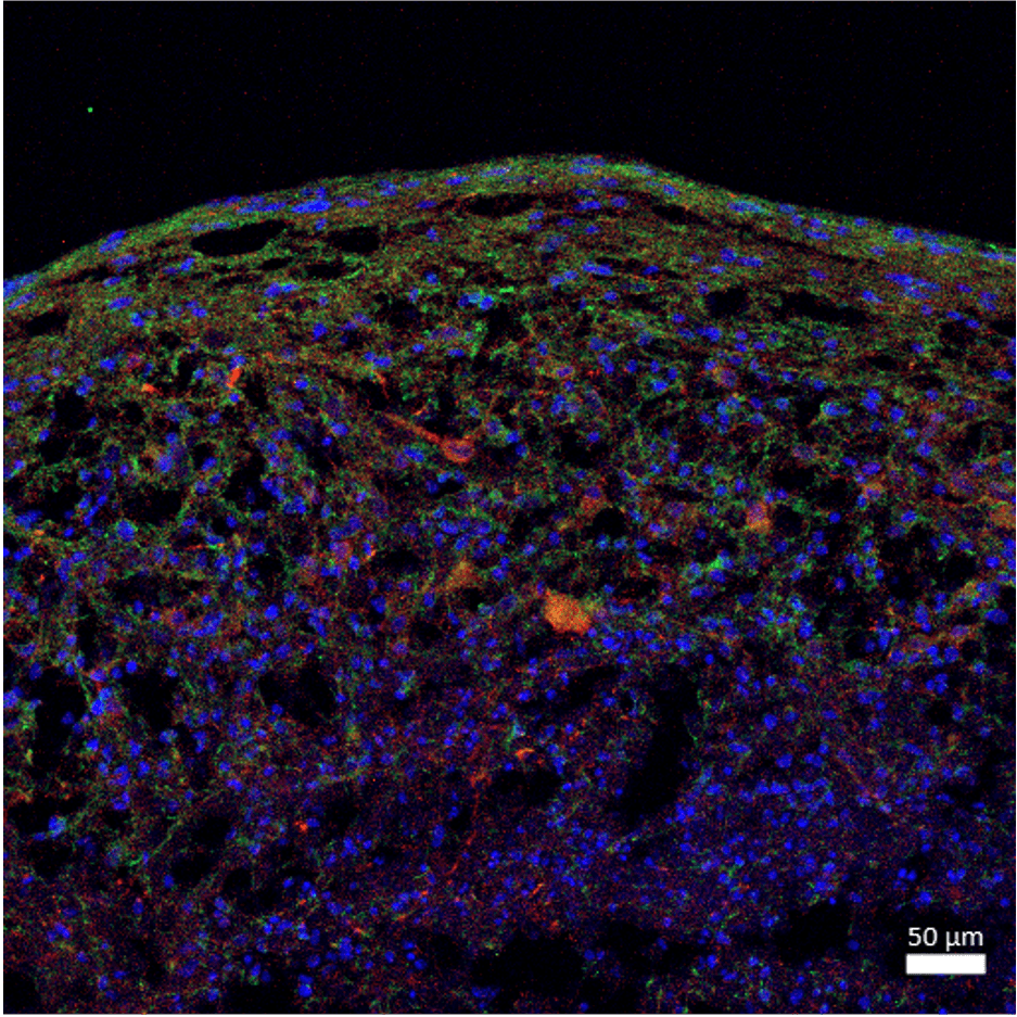 Immunostaining of organoids